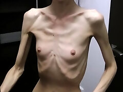 Anorexic Denisa posing and has ribs rubbed