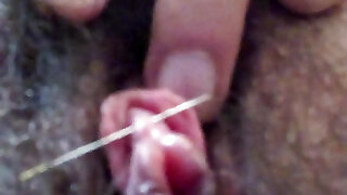 Clitoris needle piercing