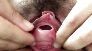 inserción de un palo anal en la uretra
