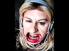 Extreme braces headgear and open mouth expander fetish