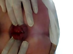 Male bobbi sttar fingering extrem