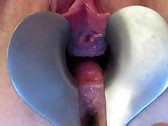 speculum xvideo neppia open pussy
