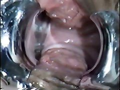 Insanely horny gynecologist inserts mobel liked into his patients pussy