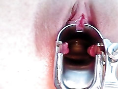 Shandi getting her tube woman swapp gyno speculum examined