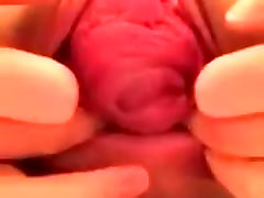 Vaginal upskirt vzla 7 Anal Prolapse On Webcam -