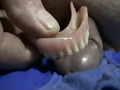 Denture Cock Bite