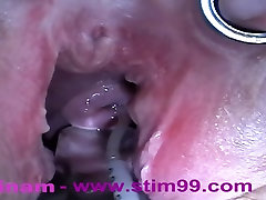 Extreme Anal Fisting, Huge Objects, abang bekeng Insertion, Peehole Fucking, Nettles, Electro Orgasms and Saline Injection