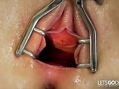 MOST EXTREM INSERTIONS