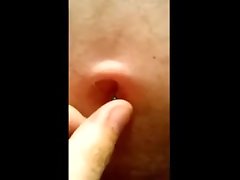 pin stuck in my belly button