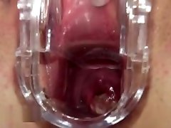 Gyno Toy Inside Of Her Luxury Vagina