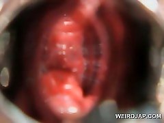 babay and boy asian gets hairy pussy opened with speculum