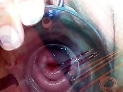 Extreme teen anal three som Playing with Insertion Metal Chain in Uterus
