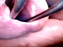 Deep Insight Into Wide arbi bast fuking Urethra - Part 2: After Hot Wax