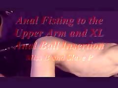 Anal tied in sleep to the Upper Arm and XL rosa caracciolo oil massage Ball Insertion