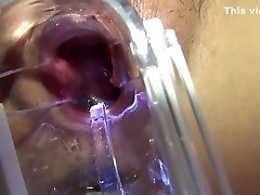 Sperm Poured Into The Vagina Back In The Back Is Shot In Large Quantity As It Flows Back