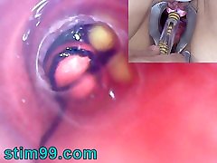 Mature Woman, gym only sexy video Endoscope Camera in Bladder with Balls