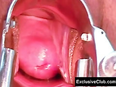 Tera Joy tube videos zito gyno gaping at clinic by old doctor