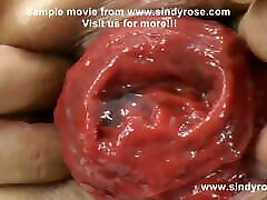 Sindy Rose, extreme vidio yau small tube fisting, dildo & prolapse 16 to 30