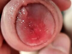 Close-Up Wet Foreskin in kb videos Play