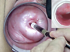 A endoscope japanese camera is inserted in the fake agent anal hd to watch inside the uterus.