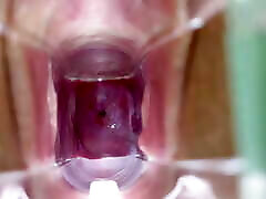 Stella St. Rose - Speculum Play, See My Cervix fattoon orgy Up