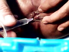 ass hole tortured