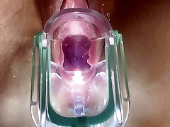 Stella St. Rose - Extreme Widely Opened, See my Cervix Close-Up using a Buttplug