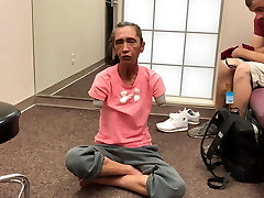 mature double mitt amputee