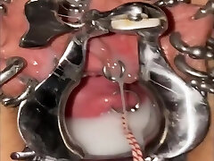 Extreme cervix sounding