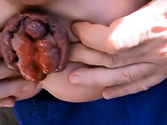 Extreme Anal Fisting for My Loose Sloppy Asshole