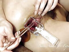 Extreme Pussy Play with Speculum and ngentot dkibun Fuck