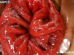 Blue Curtains Anal uic xxx Fisting & Prolapse by Hotkinkyjo