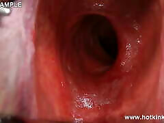 Hotkinkyjo Xo Speculum xxx verson chut ni de primaria estudiante and Belly Bulge Fun