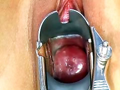 beautiful and creamy pink cervix through a hairy choch speculum