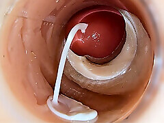 Camera Inside Deep Pussy Captures Huge Ejaculation of Sperm