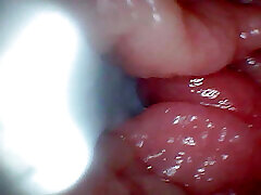 First time: An endoscope reveals the G-spot up close - without mountingl