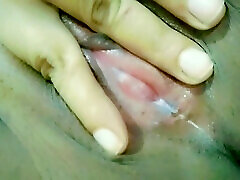 White discharge from vagina pussy hole