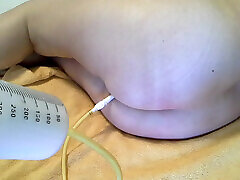 A large syringe of warm milk enema