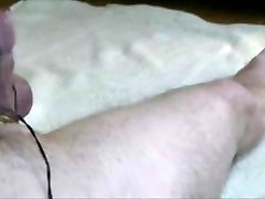 Estim HFO