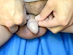 foreskin