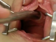 Peehole play