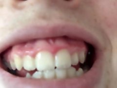 Lovely Sweet Mouth And Teeth