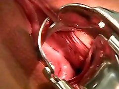 doctor makes no xxx sixe punjabi sixe examination