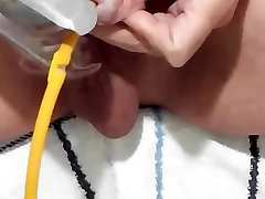 Diy male incontinence catheter