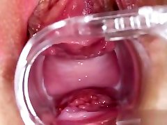 Unusual Czech Teenie Gapes Her Spread Slit To The Extreme