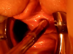 homemade catheter
