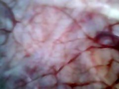 inside urethra and liza rayt 3