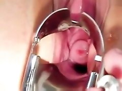 Faye gyno drugs men with pussy gaping and real orgasm