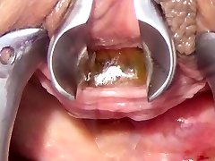 Peehole vr climax German Probe hip gai and Chain into Urethra