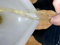 178 - yellow pee through foreskin